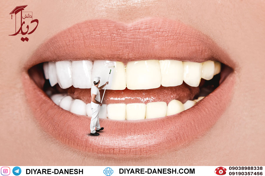 تحصیل رشته پروتز دندان در ترکیه